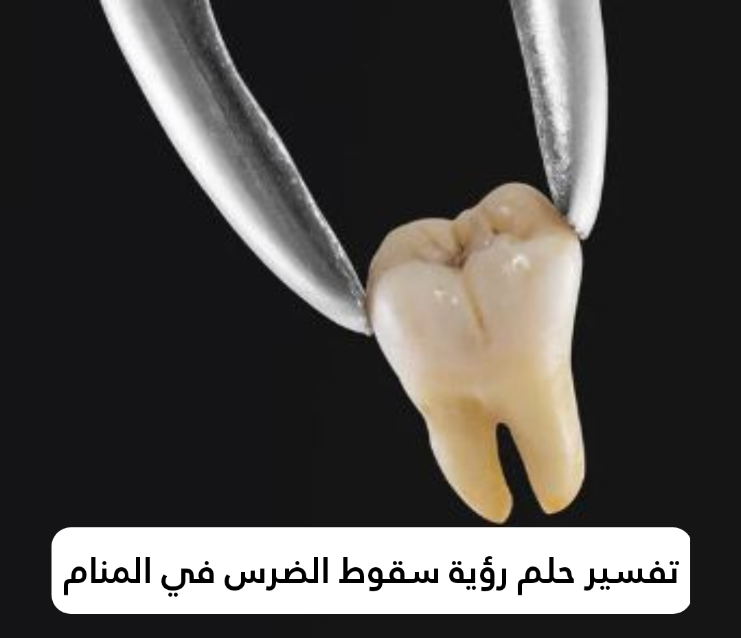 تفسير حلم رؤية سقوط الضرس في المنام