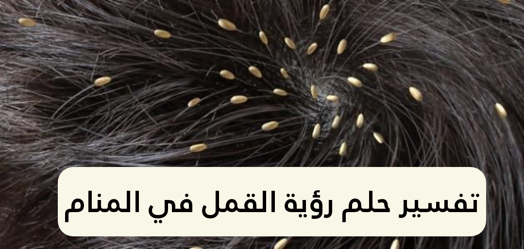 تفسير حلم رؤية القمل في المنام